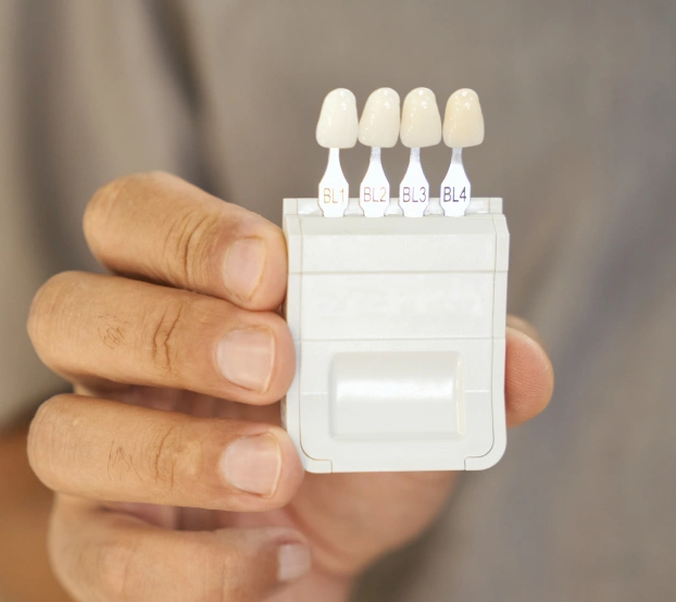 Hand holding a dental shade guide displaying four porcelain veneer tooth samples.